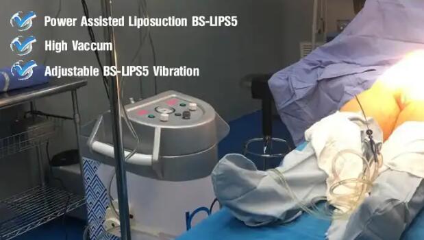 BS-LIPS5 LipoPlus PAL Advanced Power Assisted Liposuction System_001.jpg